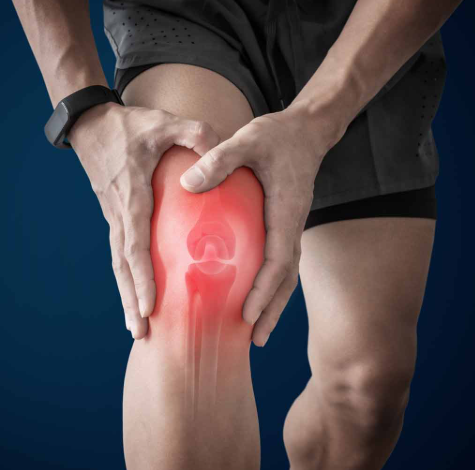 Effective Natural Remedies for Treating Tendonitis